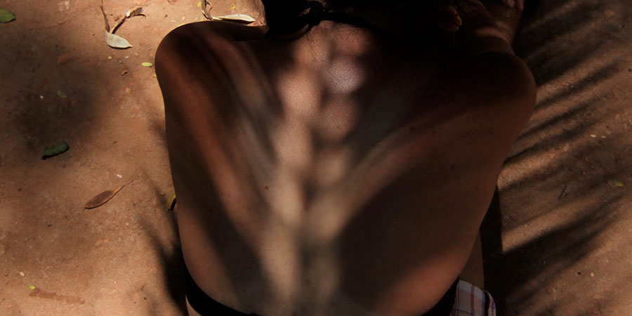 Causas de la espina bífida