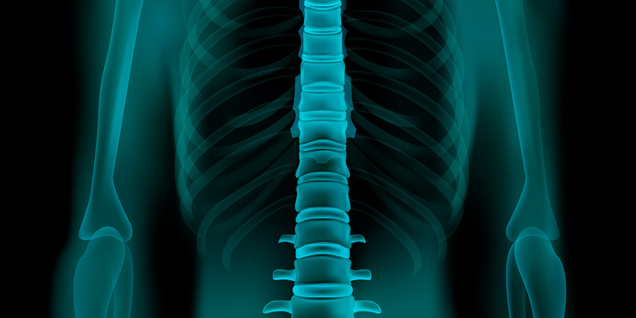 Complicaciones de la siringomielia