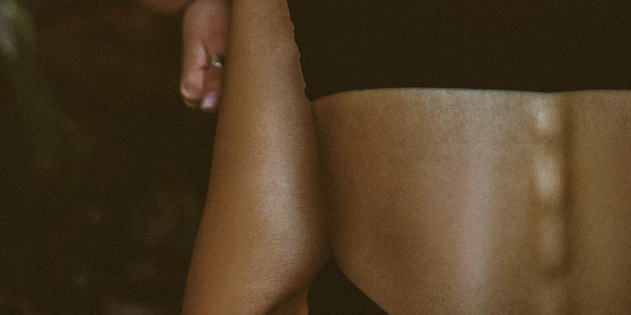 Diagnóstico y tratamiento de la espondilolistesis