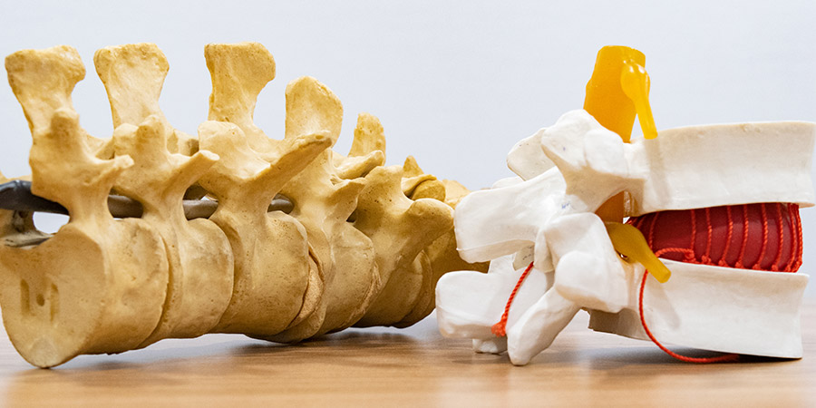 Es dolorosa la rizólisis