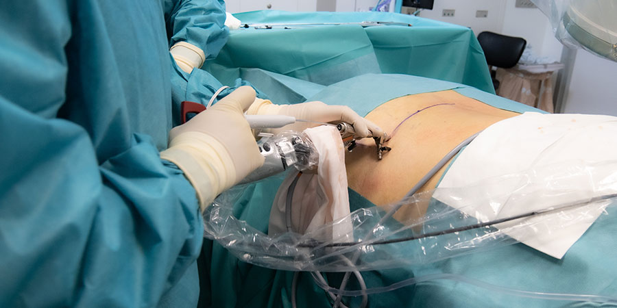 Expertos en cirugía endoscópica de columna en España