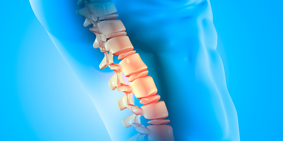 foraminotomía cirugia