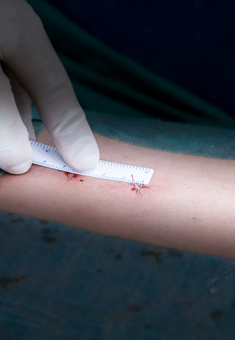 ICAC Marbella_¿por qué clínica_ 2