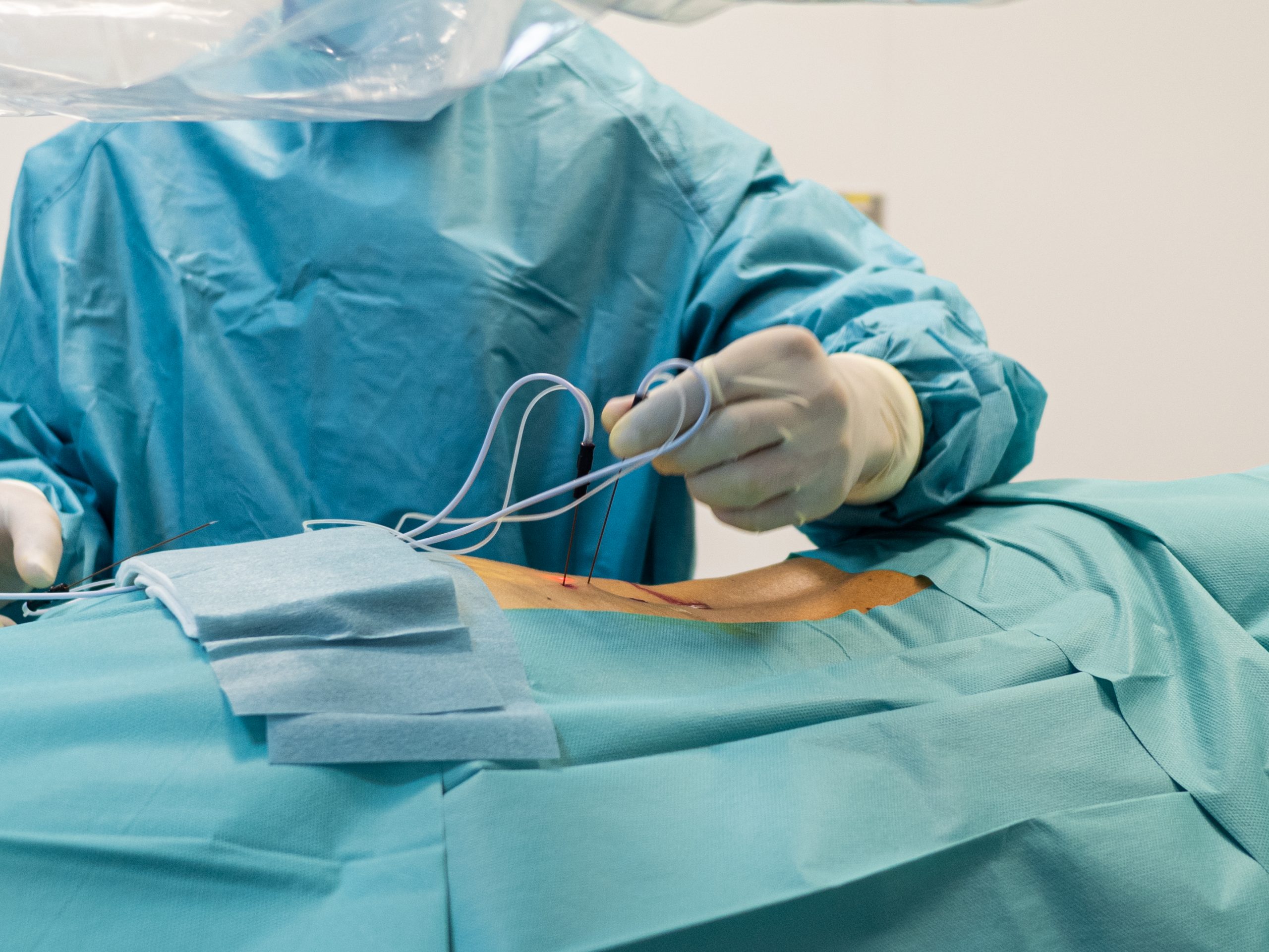 opreacion fibrosis compresiva hernia L3L4