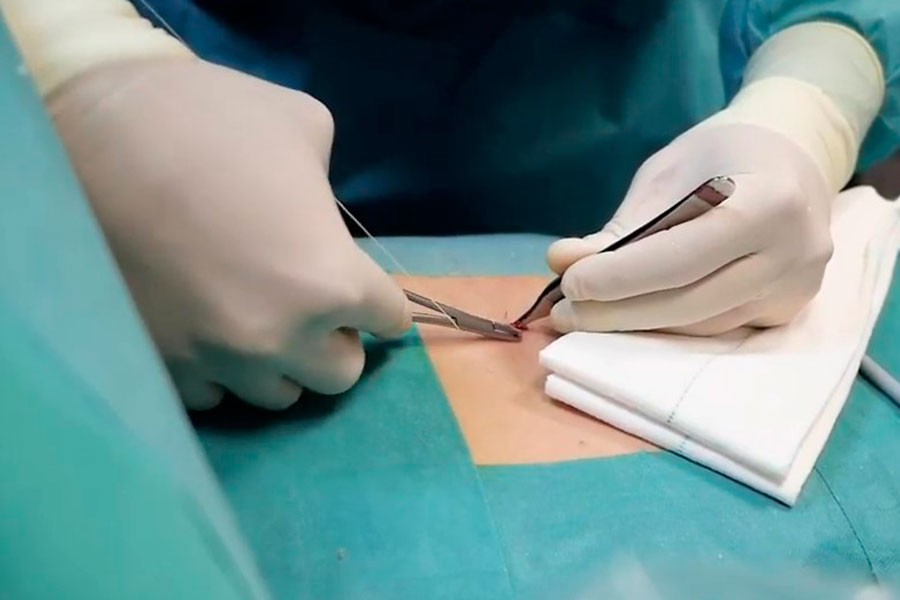 postoperatorio-hernia-discal