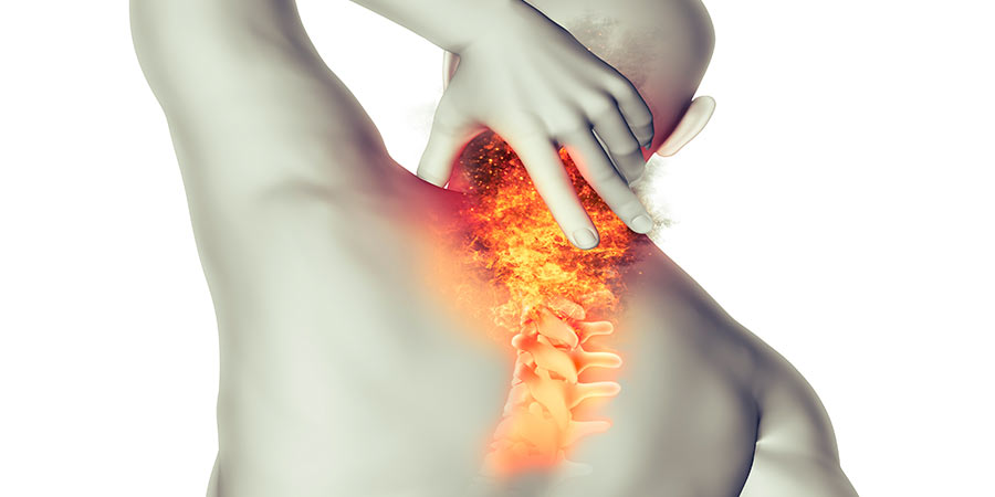 Qué es un esguince cervical y cuáles son sus causas