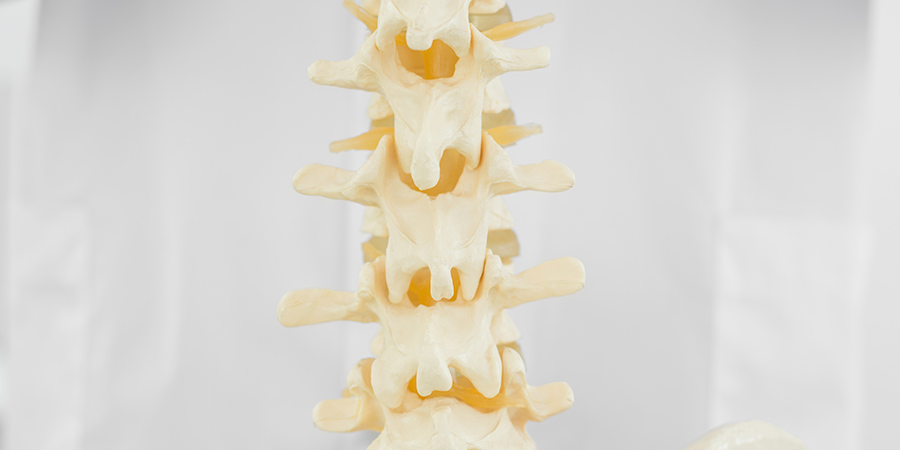 que es disostosis espondilotorácica sintomas