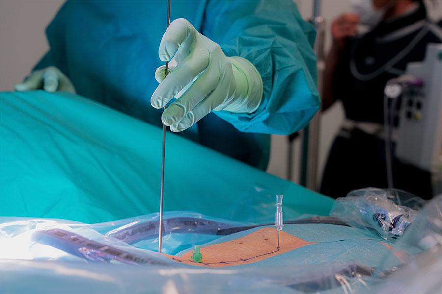 que es ICAC endoscopia avanzada de columna