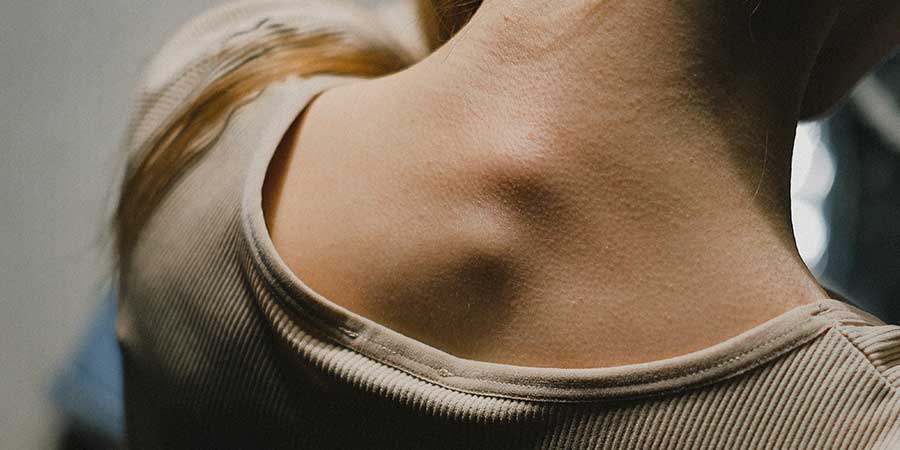 Tipos de cervicalgia