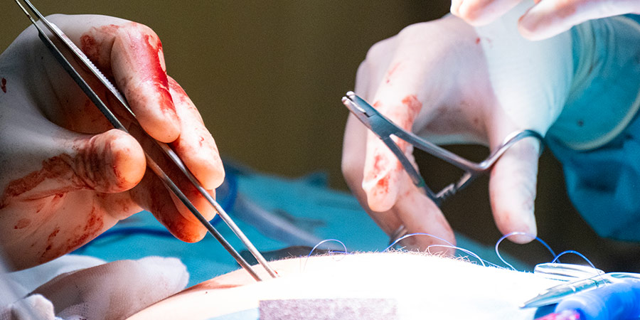 Tipos-y-técnicas-de-cirugía-de-columna-vertebral