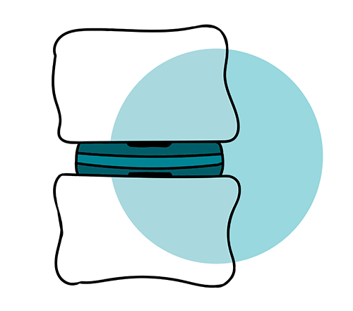 icono protesis cervical anatomica